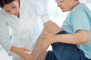 Varicose Veins