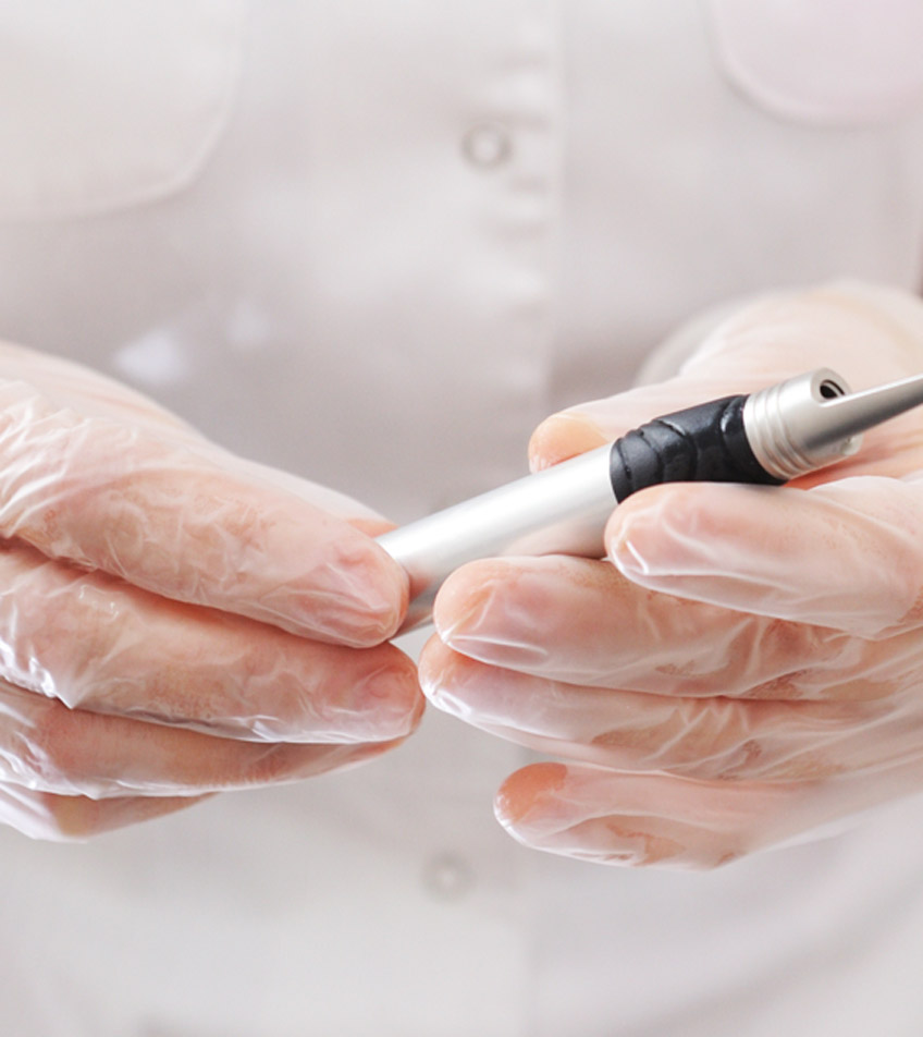Healthcare-practitioner-holding-laser-for-spider-veins-treatment-in-Las-Vegas