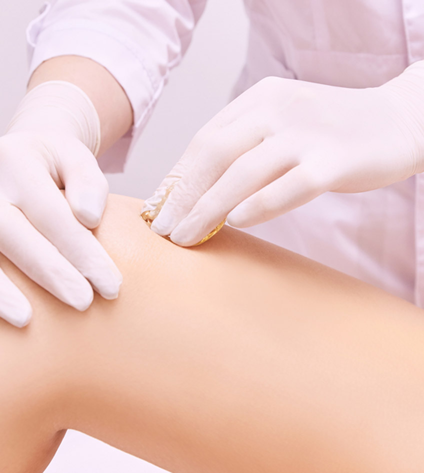 Patient-undergoing-varicose-veins-removal-in-Las-Vegas